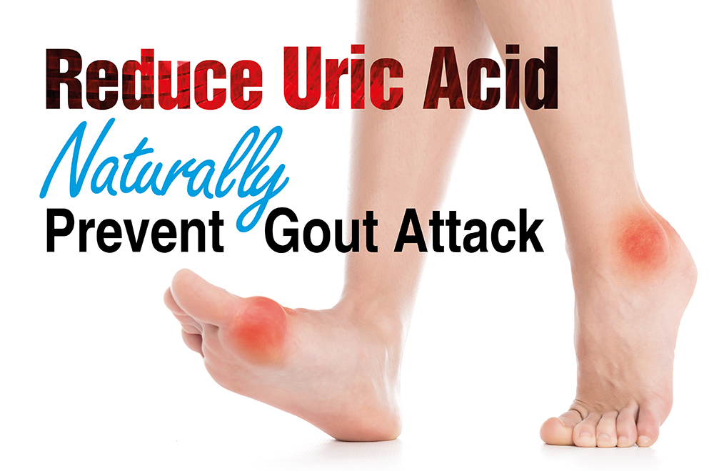 uric acid คือ deficiency